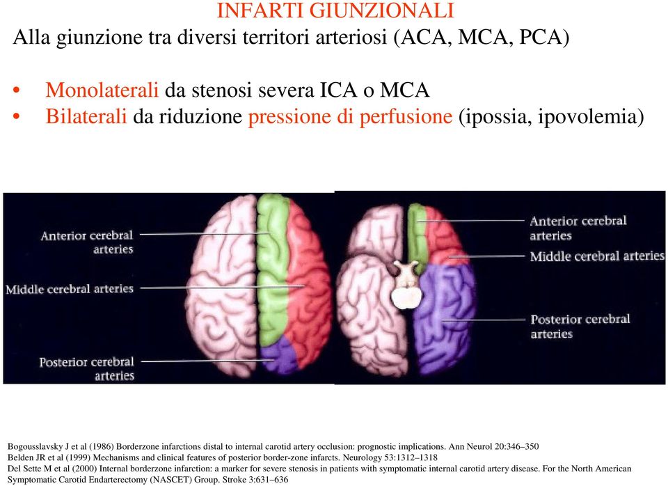 Ann Neurol 20:346 350 Belden JR et al (1999) Mechanisms and clinical features of posterior border-zone infarcts.