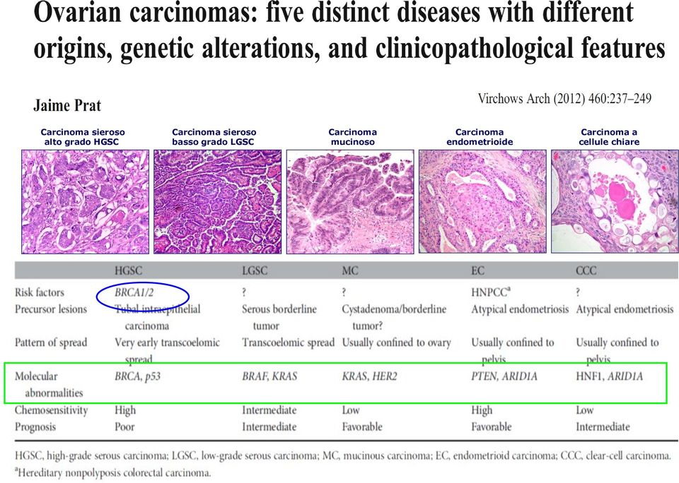 Carcinoma mucinoso Carcinoma