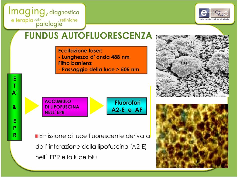 LIPOFUSCINA NELL EPR Fluorofori A2-E e AF Emissione di luce fluorescente