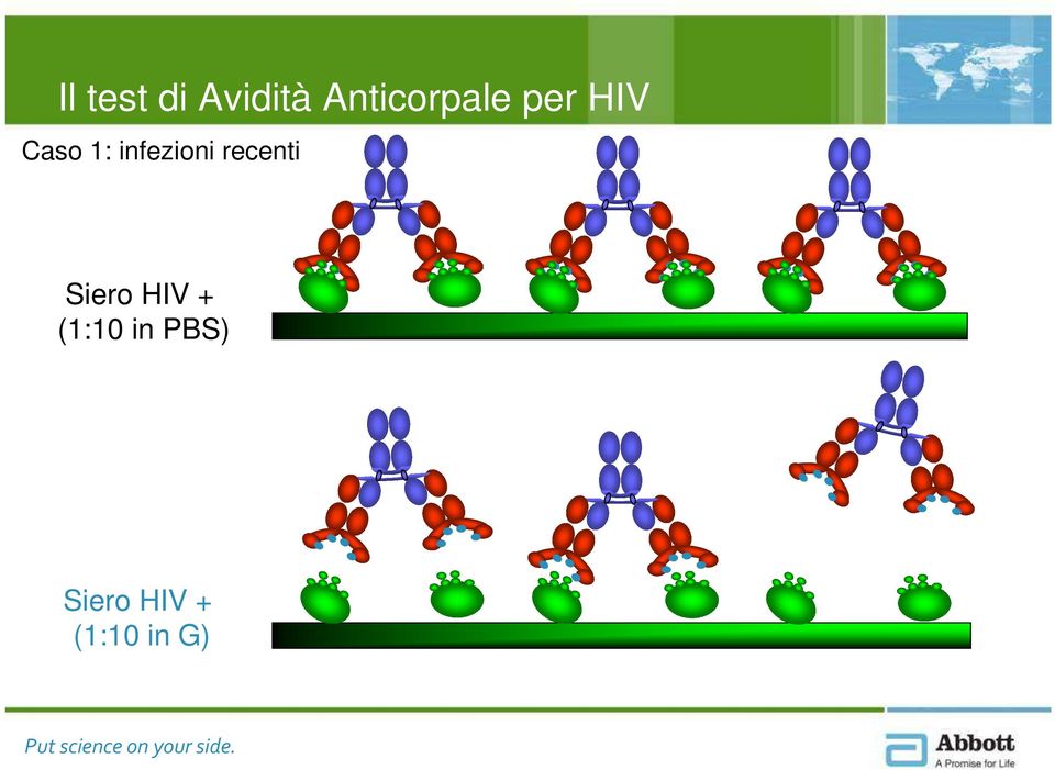 infezioni recenti Siero HIV