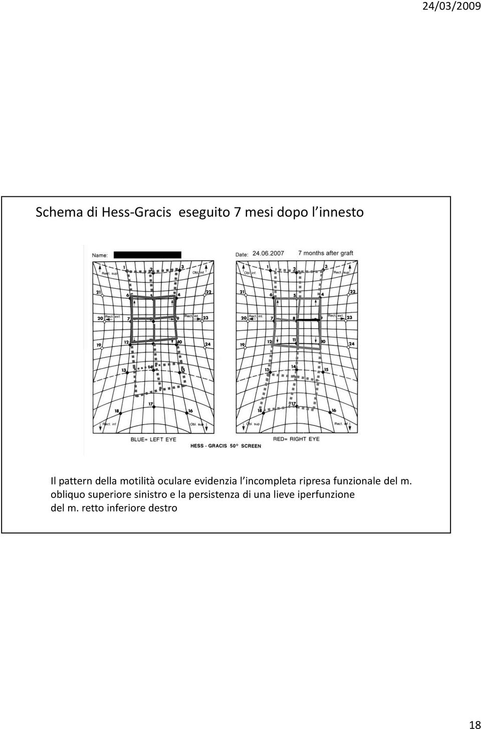 ripresa funzionale del m.