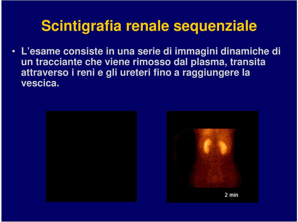 tracciante che viene rimosso dal plasma, transita