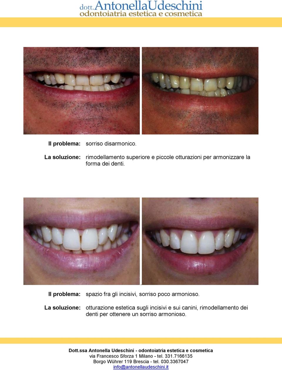 la forma dei denti.