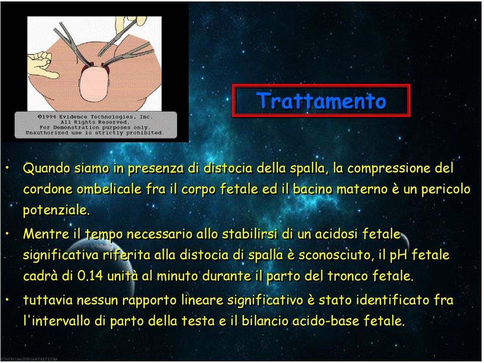 Mentre il tempo necessario allo stabilirsi di un acidosi fetale significativa riferita alla distocia di spalla è sconosciuto,