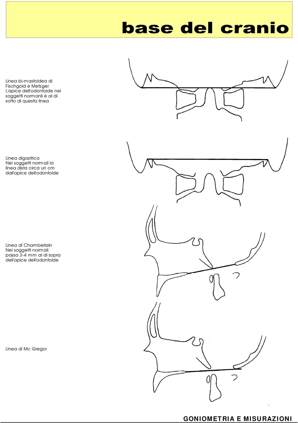 linea dista circa un cm dall'apice dell'odontoide Linea di Chamberlain Nei