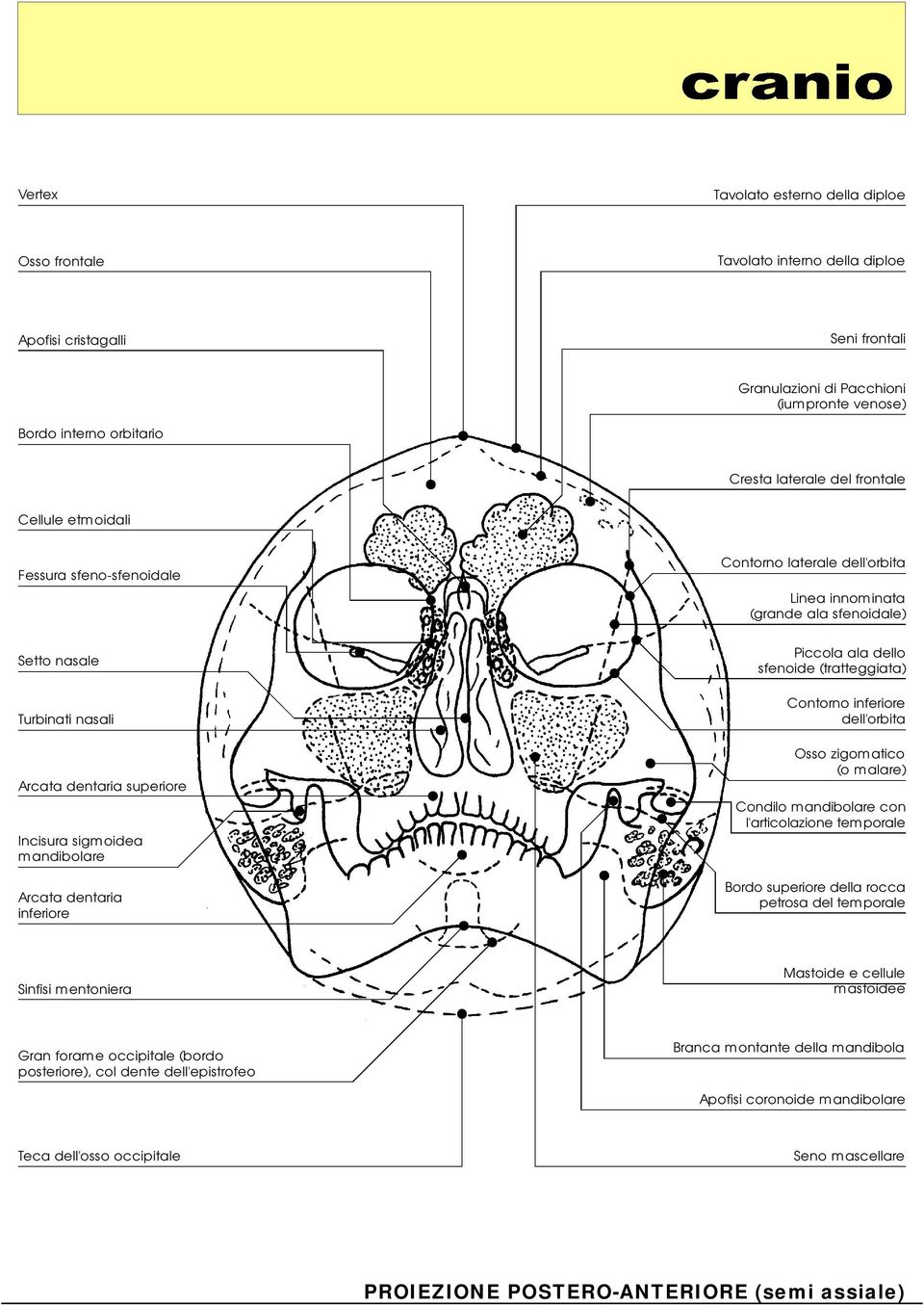 Linea innominata (grande ala sfenoidale) Piccola ala dello sfenoide (tratteggiata) Contorno inferiore dell'orbita Osso zigomatico (o malare) Condilo mandibolare con l'articolazionetemporale Bordo