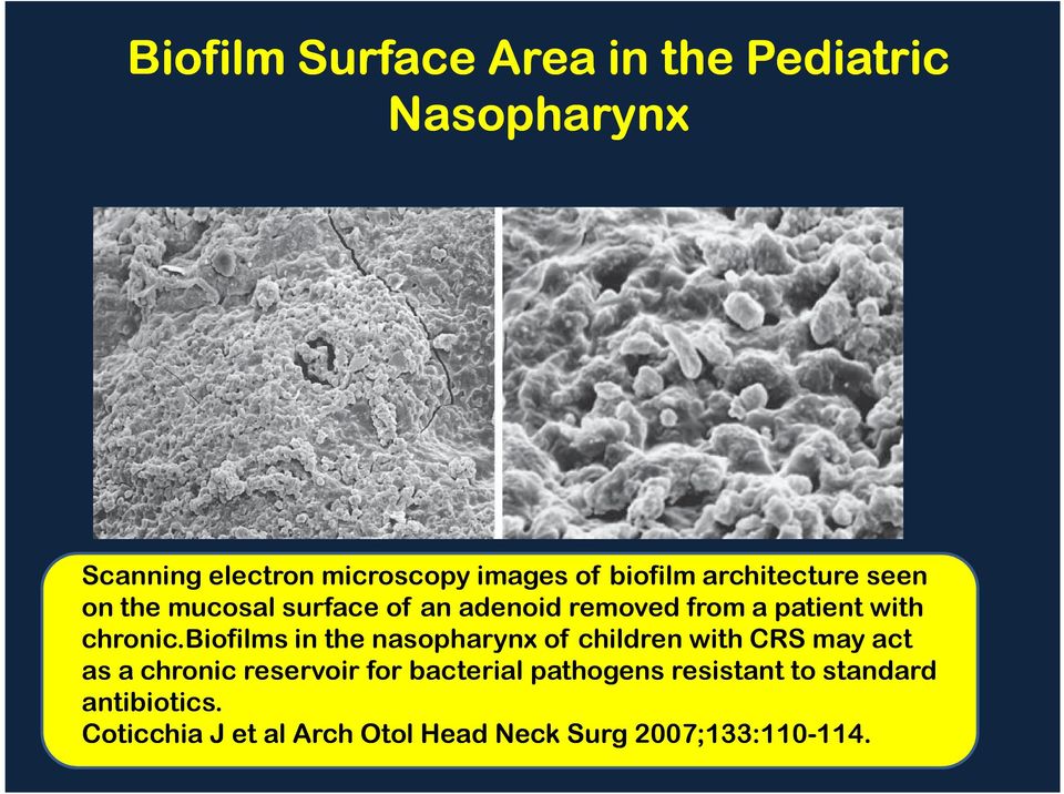 biofilms in the nasopharynx of children with CRS may act as a chronic reservoir for bacterial
