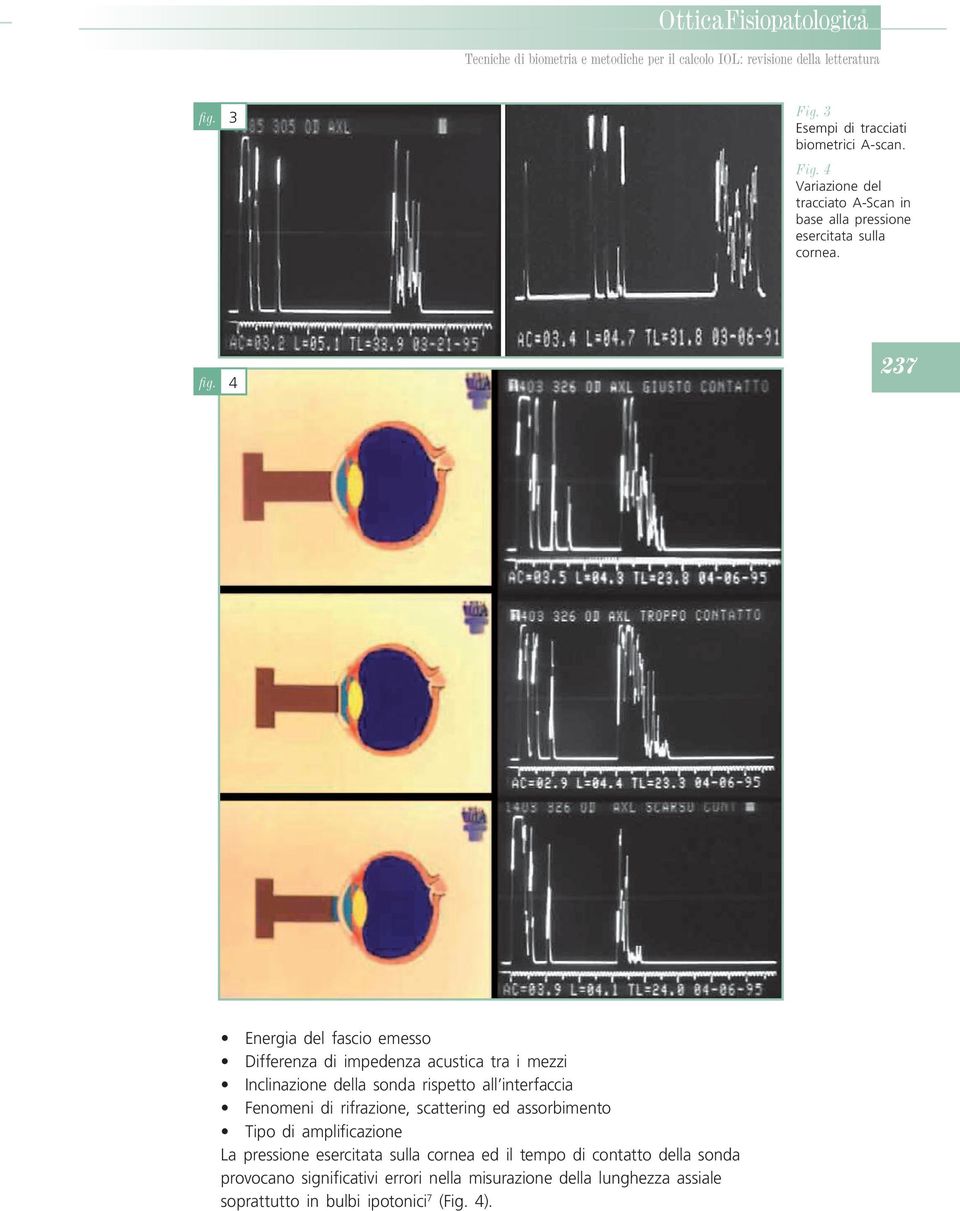 Fenomeni di rifrazione, scattering ed assorbimento Tipo di amplificazione La pressione esercitata sulla cornea ed il tempo di