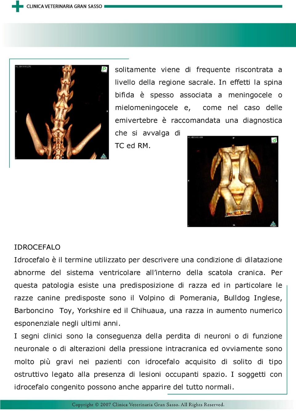 IDROCEFALO Idrocefalo è il termine utilizzato per descrivere una condizione di dilatazione abnorme del sistema ventricolare all interno della scatola cranica.