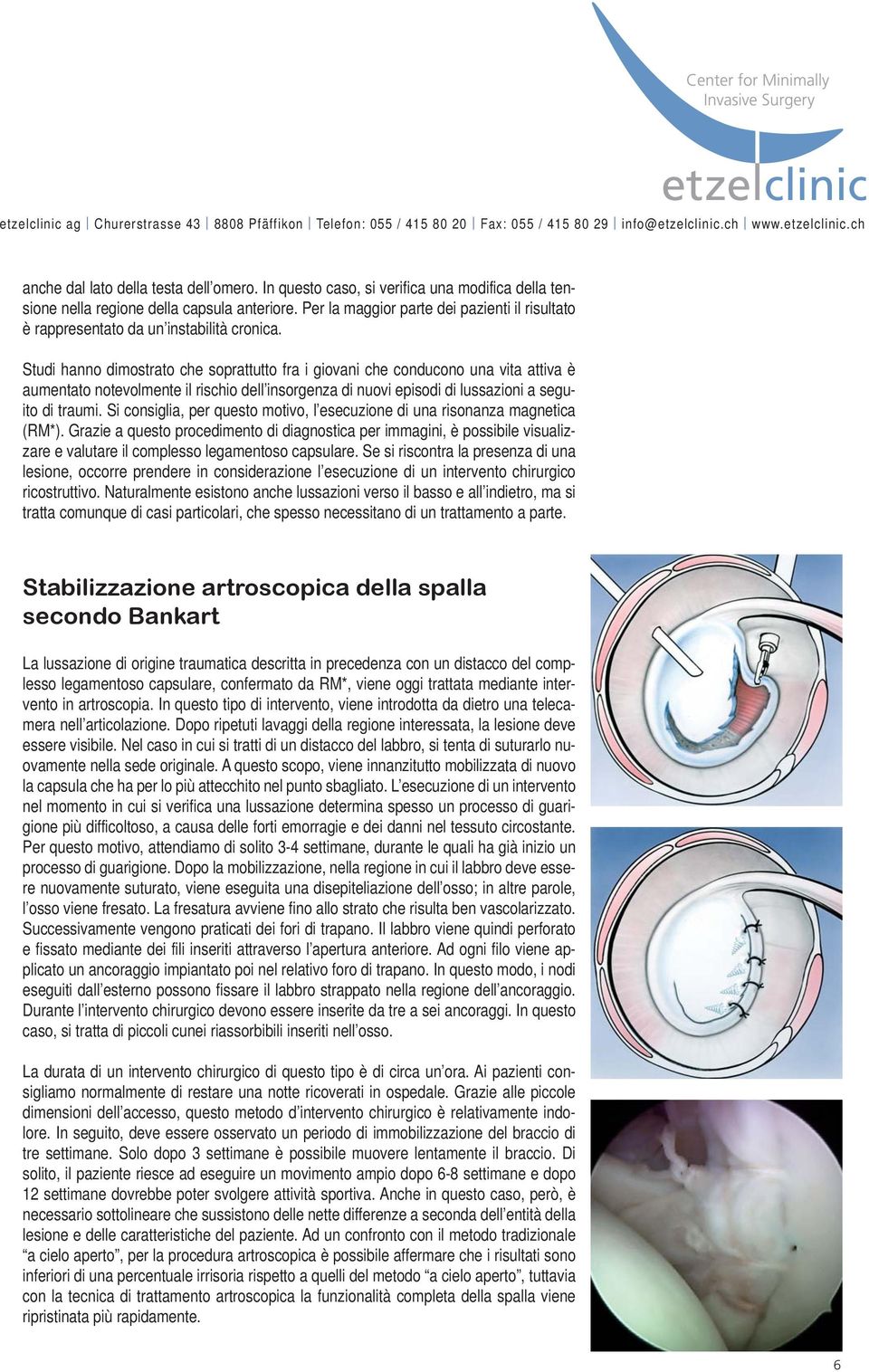 Studi hanno dimostrato che soprattutto fra i giovani che conducono una vita attiva è aumentato notevolmente il rischio dell insorgenza di nuovi episodi di lussazioni a seguito di traumi.