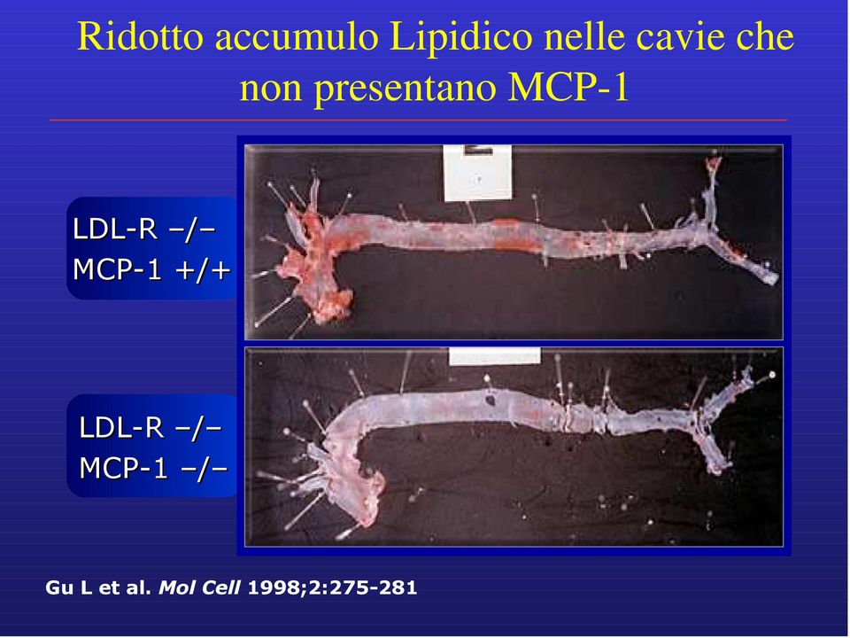 LDL-R / MCP-1 +/+ LDL-R / MCP-1