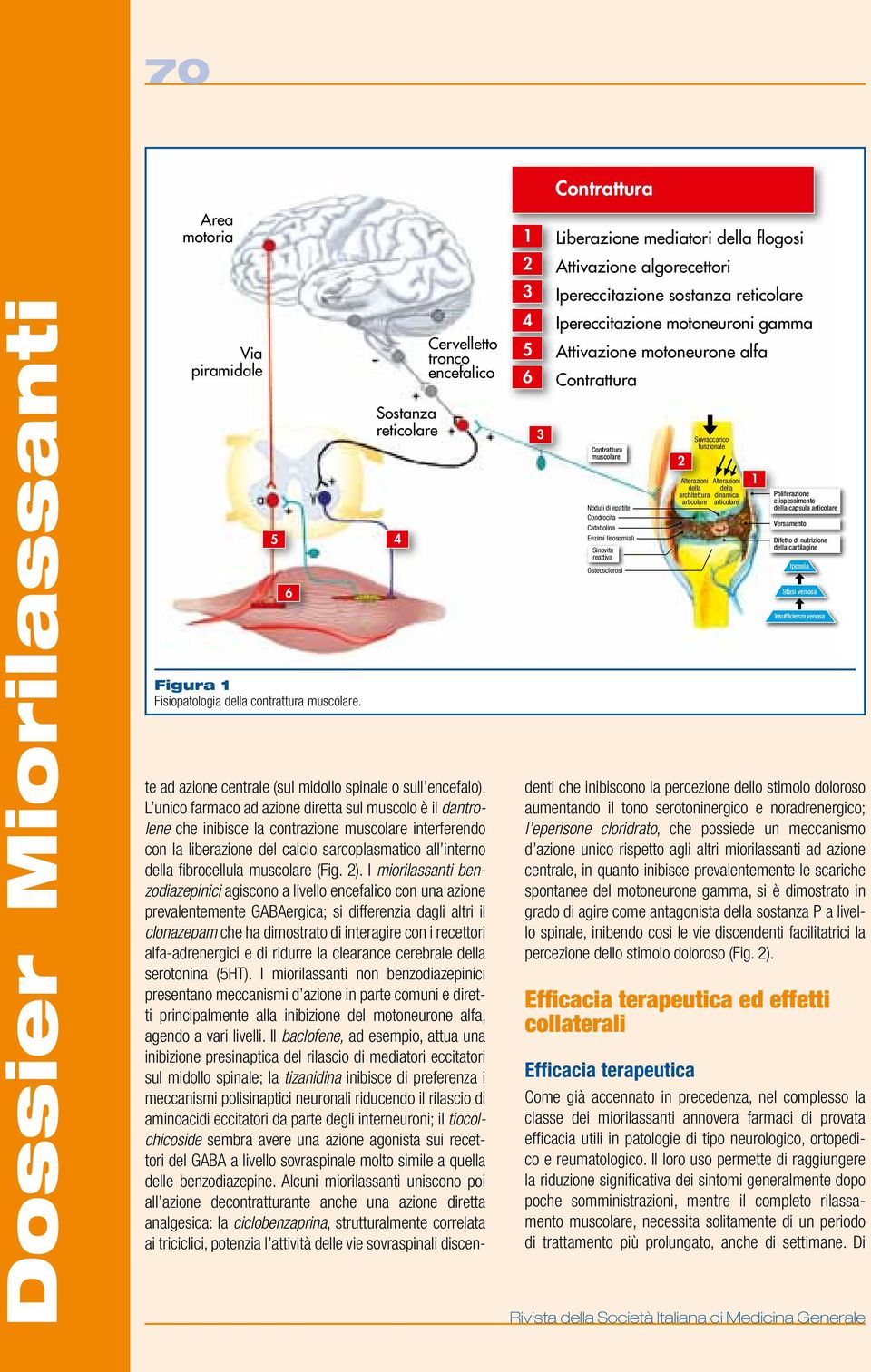 gamma Attivazione motoneurone alfa Contrattura Contrattura muscolare Noduli di epatite Condrocita Catabolina Enzimi lisosomiali Sinovite reattiva Osteosclerosi te ad azione centrale (sul midollo