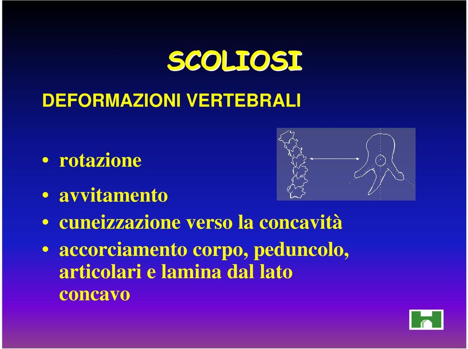 concavità accorciamento corpo,