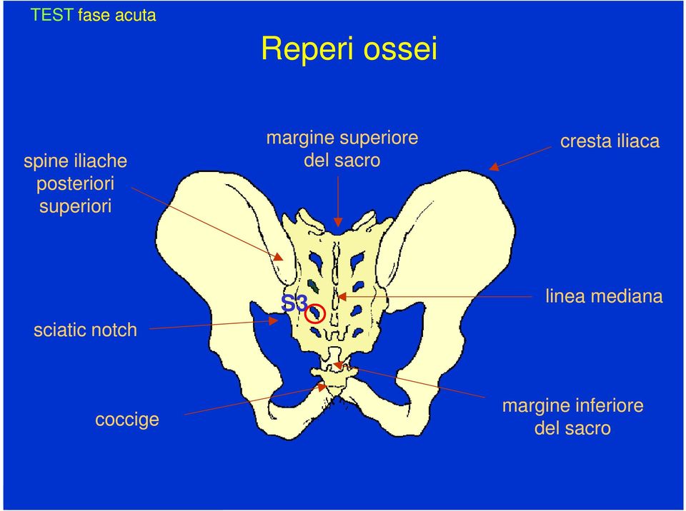 sacro cresta iliaca sciatic notch S3 linea