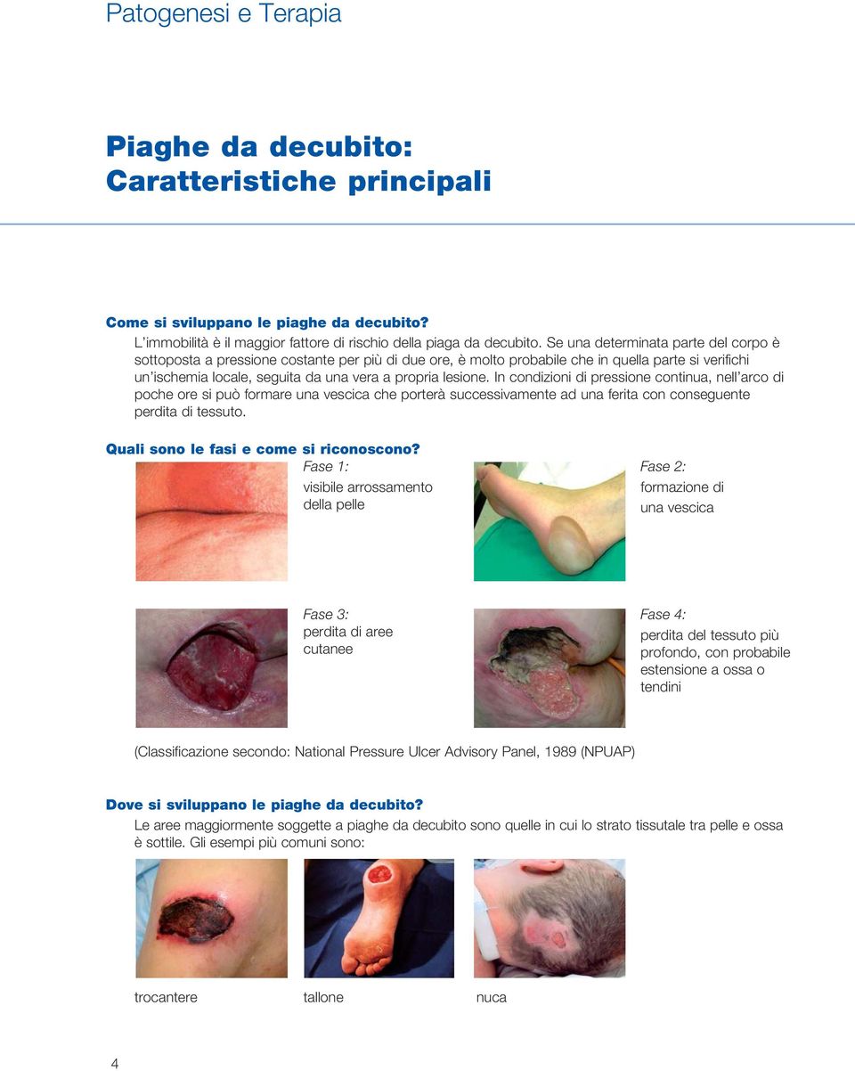 In condizioni di pressione continua, nell arco di poche ore si può formare una vescica che porterà successivamente ad una ferita con conseguente perdita di tessuto.