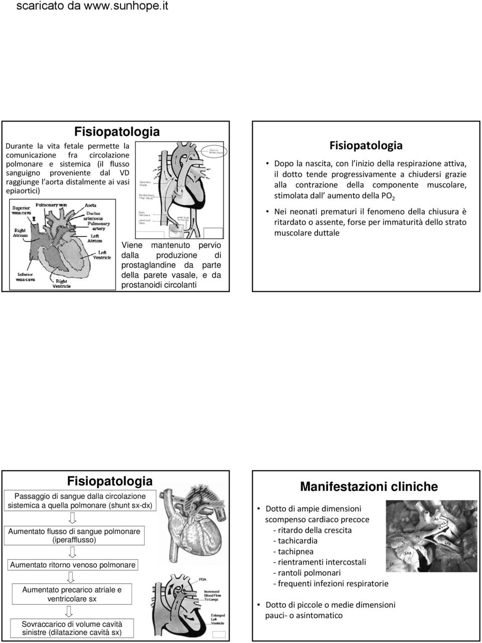 progressivamente a chiudersi grazie alla contrazione della componente muscolare, stimolata dall aumento della PO 2 Nei neonati prematuri il fenomeno della chiusura è ritardato o assente, forse per