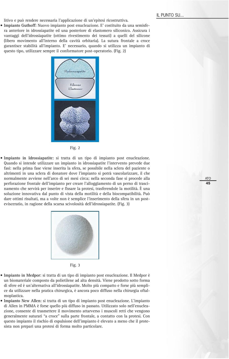 Assicura i vantaggi dell idrossiapatite (ottimo rivestimento dei tessuti) a quelli del silicone (libero movimento all interno della cavità orbitaria).