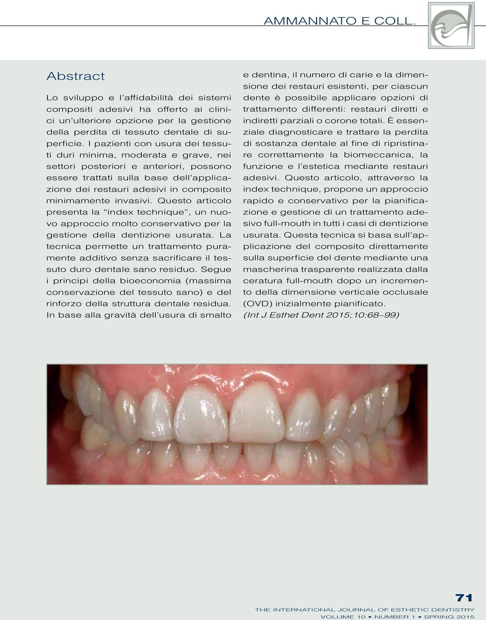 invasivi. Questo articolo presenta la index technique, un nuovo approccio molto conservativo per la gestione della dentizione usurata.