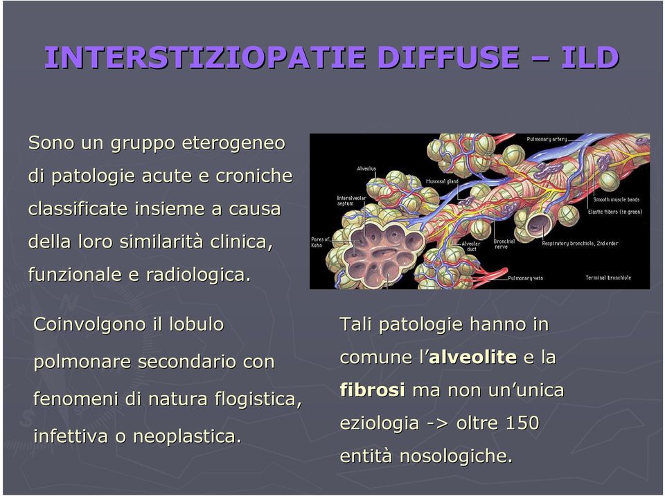 Coinvolgono il lobulo polmonare secondario con fenomeni di natura flogistica, infettiva o