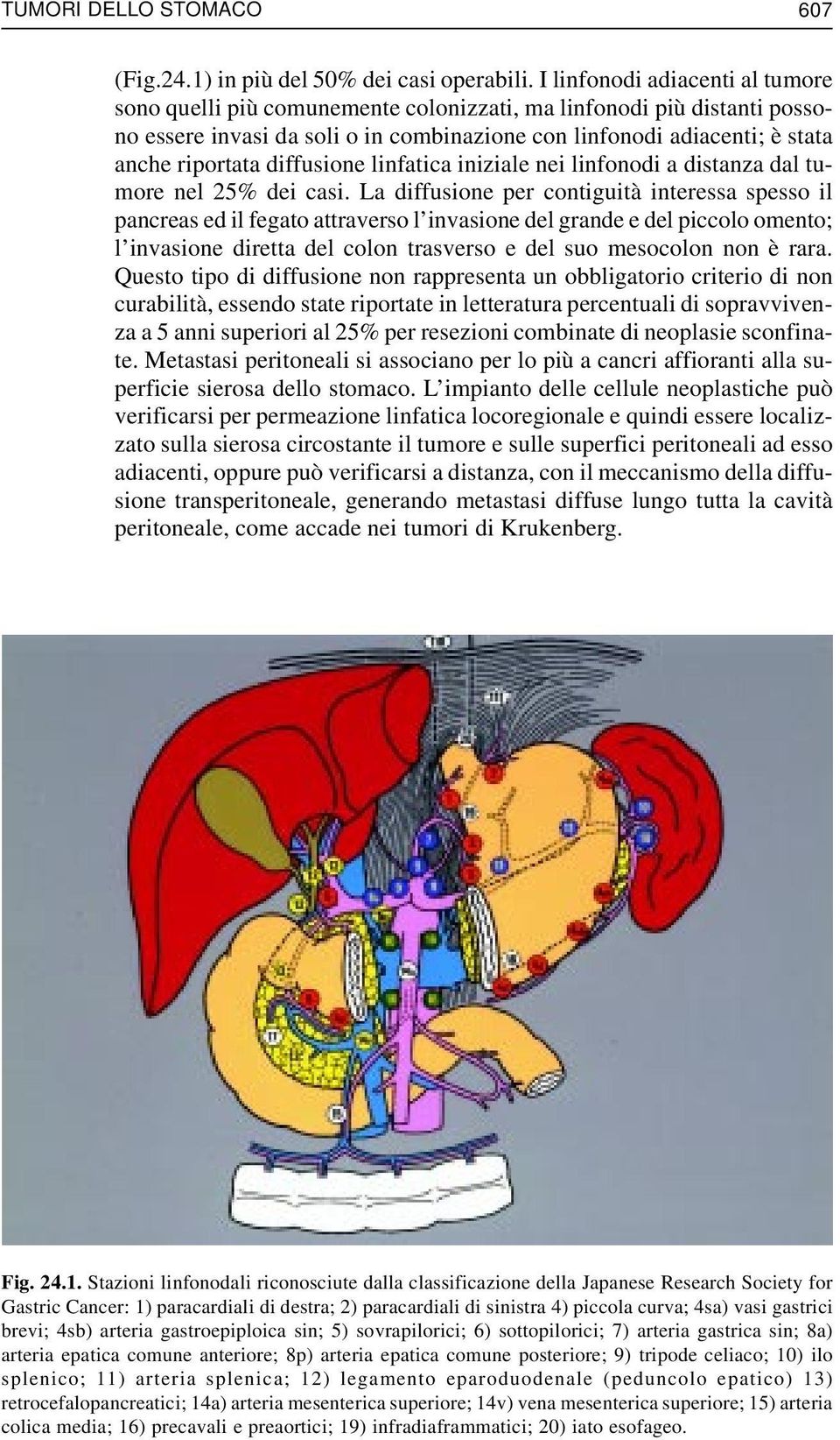 diffusione linfatica iniziale nei linfonodi a distanza dal tumore nel 25% dei casi.