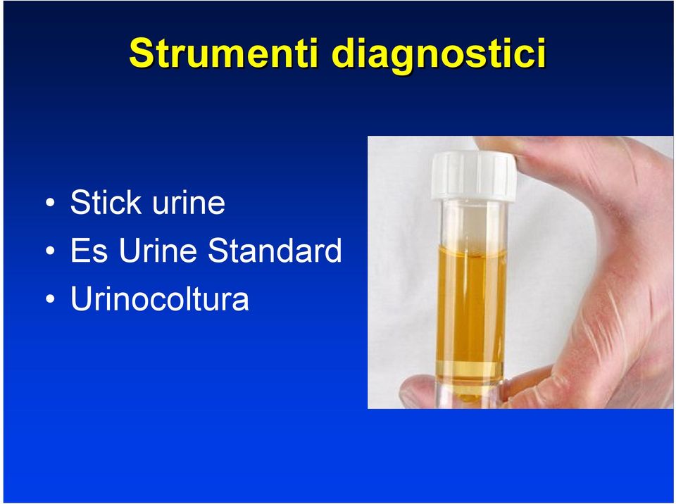 Stick urine Es