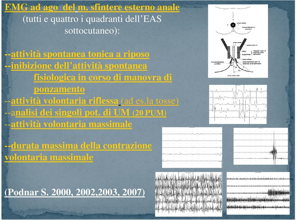 fisiologica in corso di manovra di ponzamento --attività volontaria riflessa (ad es.la tosse) --analisi dei singoli pot.