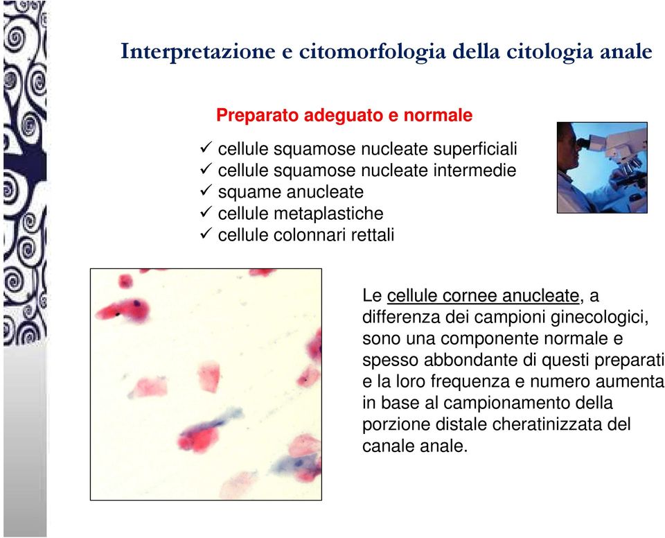 cellule cornee anucleate, a differenza dei campioni ginecologici, sono una componente normale e spesso abbondante di