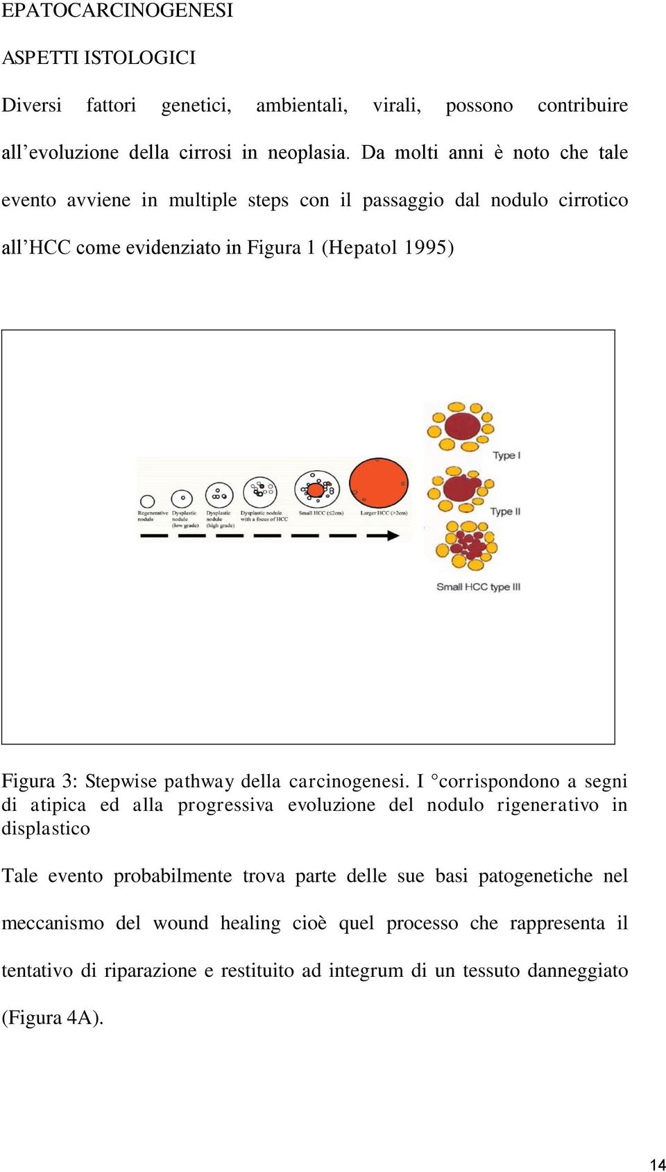 Stepwise pathway della carcinogenesi.