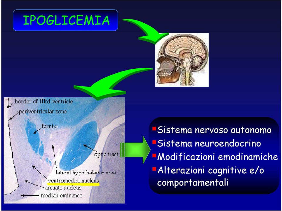 Modificazioni emodinamiche