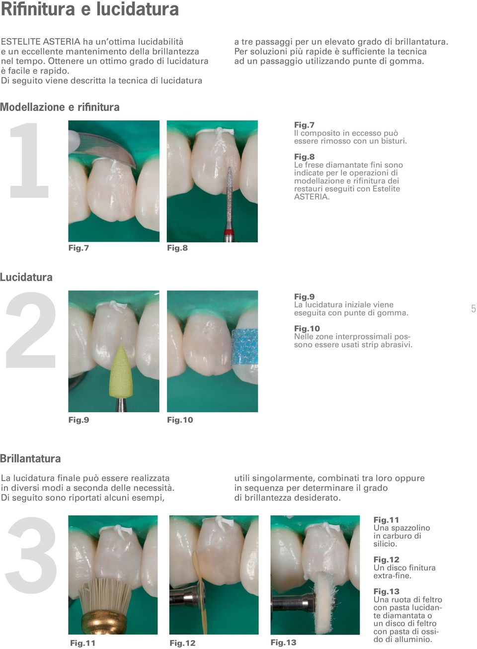 Modellazione e rifinitura Fig.7 Il composito in eccesso può essere rimosso con un bisturi. Fig.8 Le frese diamantate fini sono indicate per le operazioni di modellazione e rifinitura dei restauri eseguiti con Estelite ASTERIA.