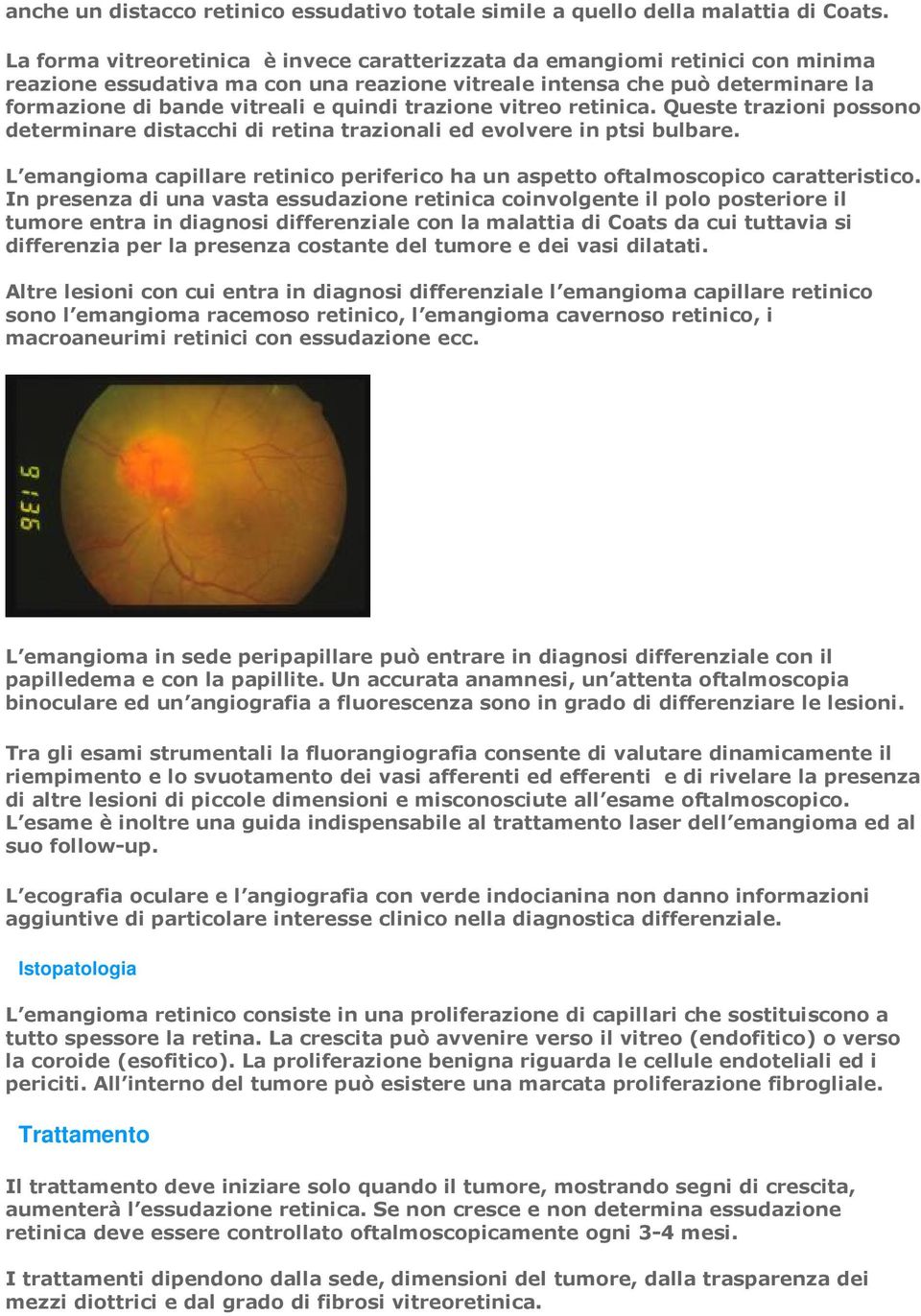 trazione vitreo retinica. Queste trazioni possono determinare distacchi di retina trazionali ed evolvere in ptsi bulbare.