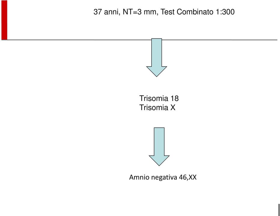 Trisomia 18 Trisomia