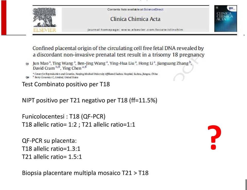 5%) Funicolocentesi : T18 (QF-PCR) T18 allelic ratio= 1:2 ; T21