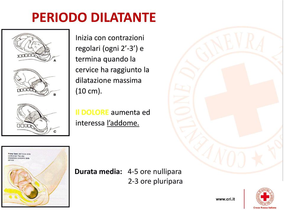 dilatazione massima (10 cm).