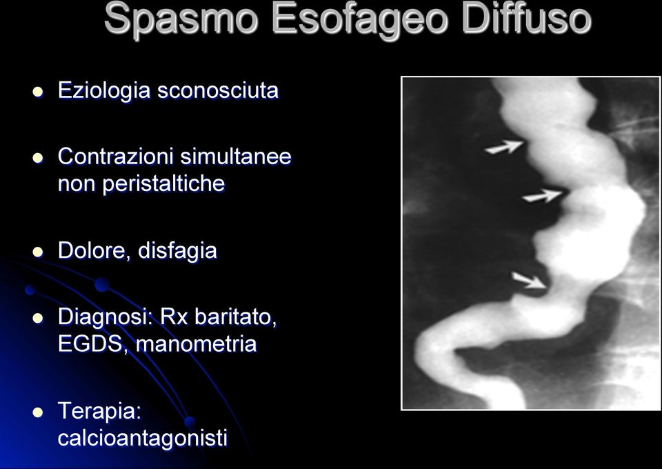 peristaltiche l Dolore, disfagia l Diagnosi: