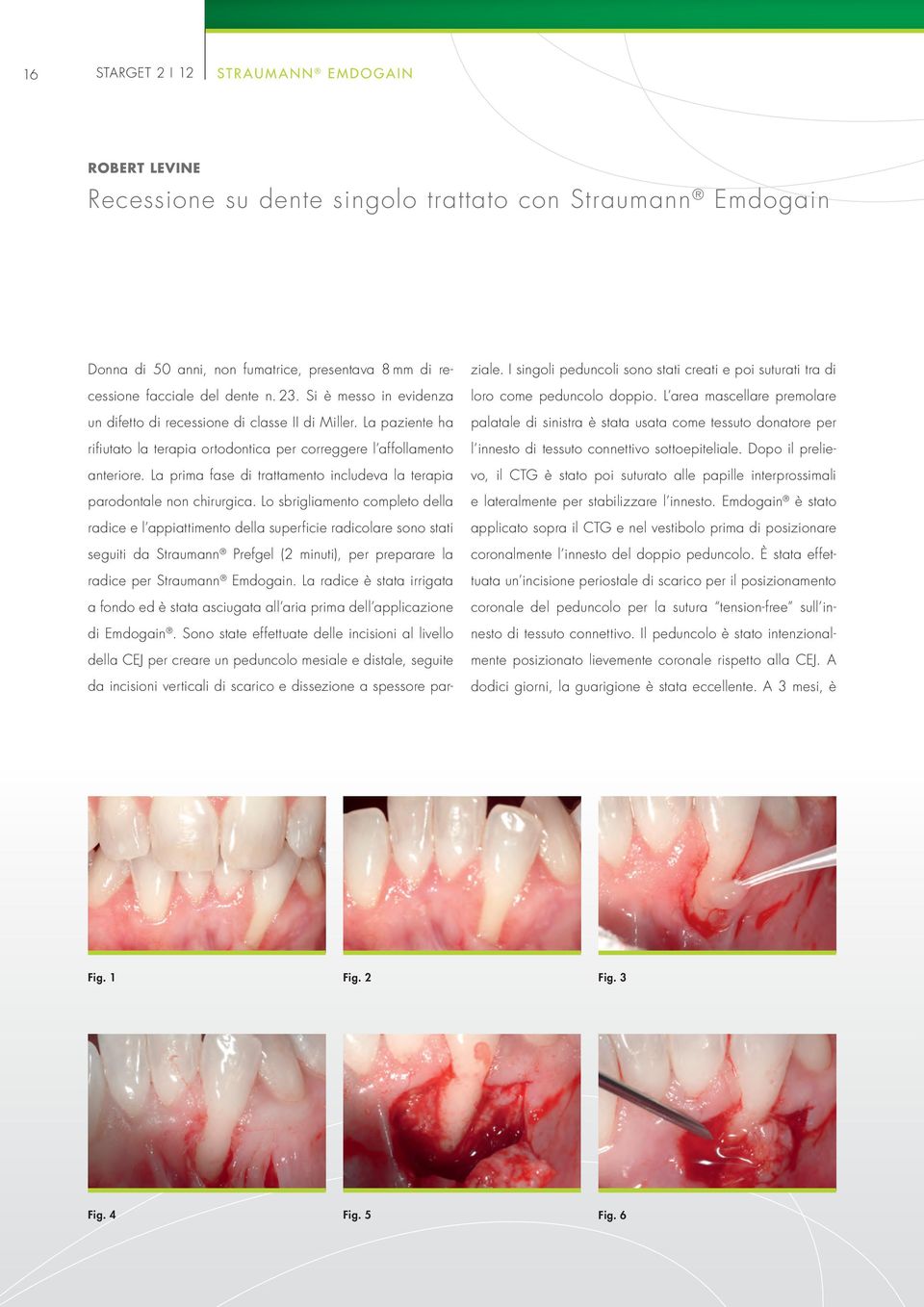 La prima fase di trattamento includeva la terapia parodontale non chirurgica.