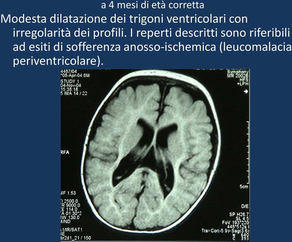 I reperti descritti sono riferibili ad esiti di