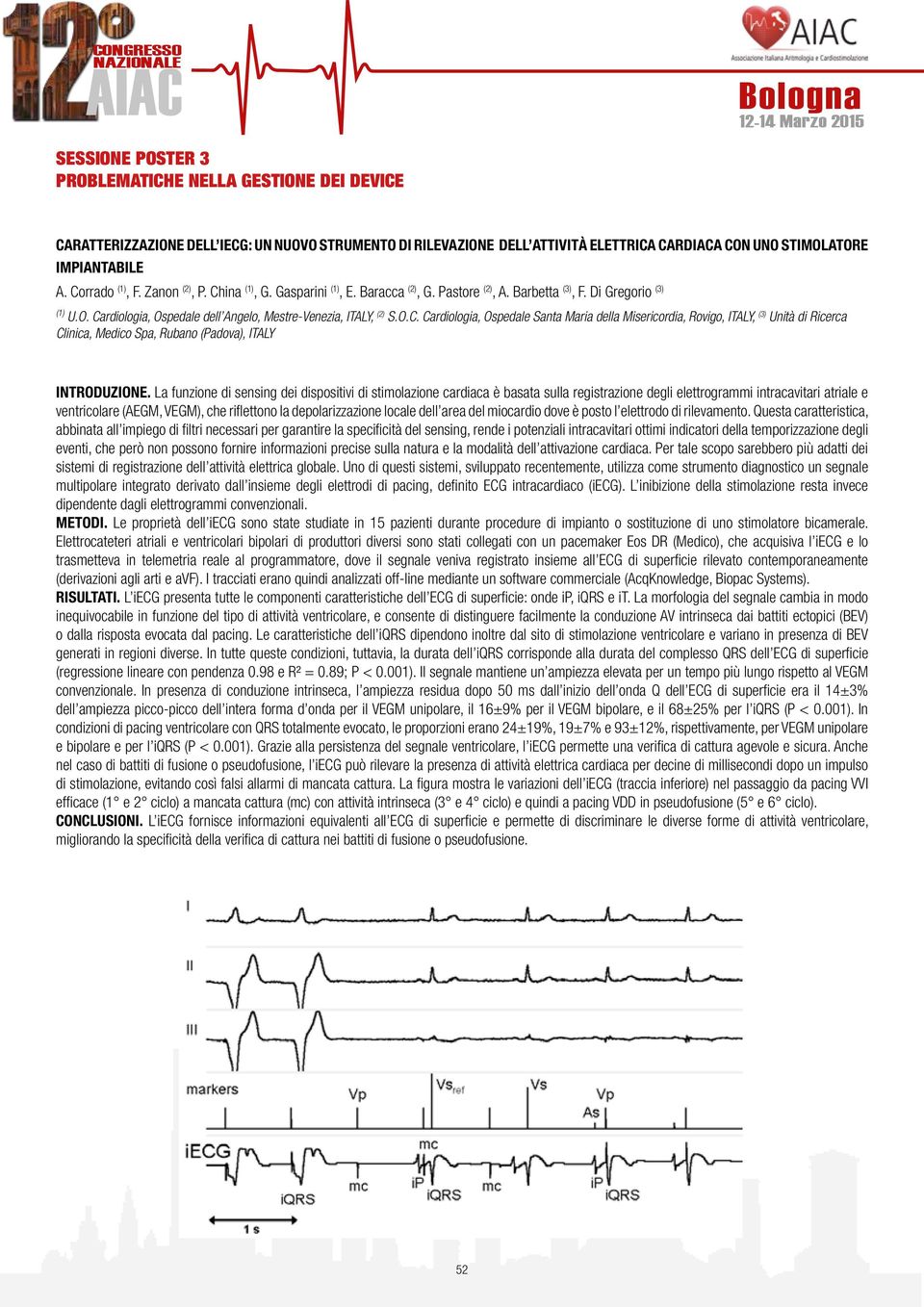 La funzione di sensing dei dispositivi di stimolazione cardiaca è basata sulla registrazione degli elettrogrammi intracavitari atriale e ventricolare (AEGM, VEGM), che riflettono la depolarizzazione