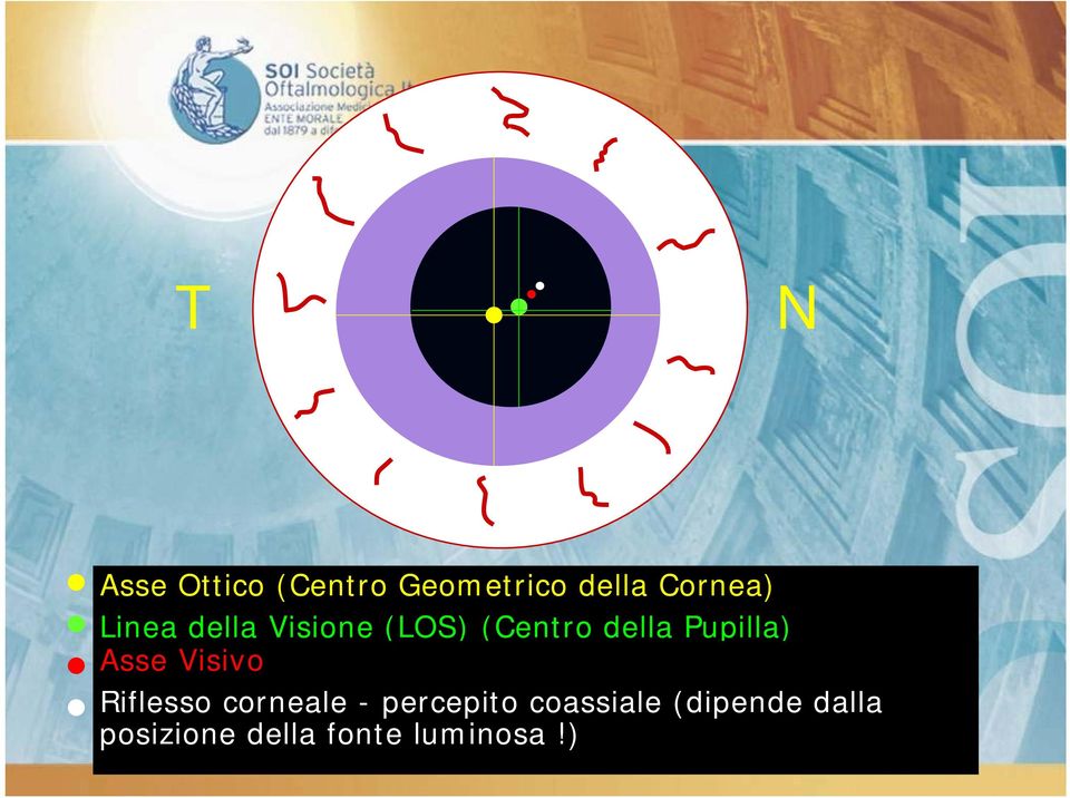 Asse Visivo Riflesso corneale - percepito