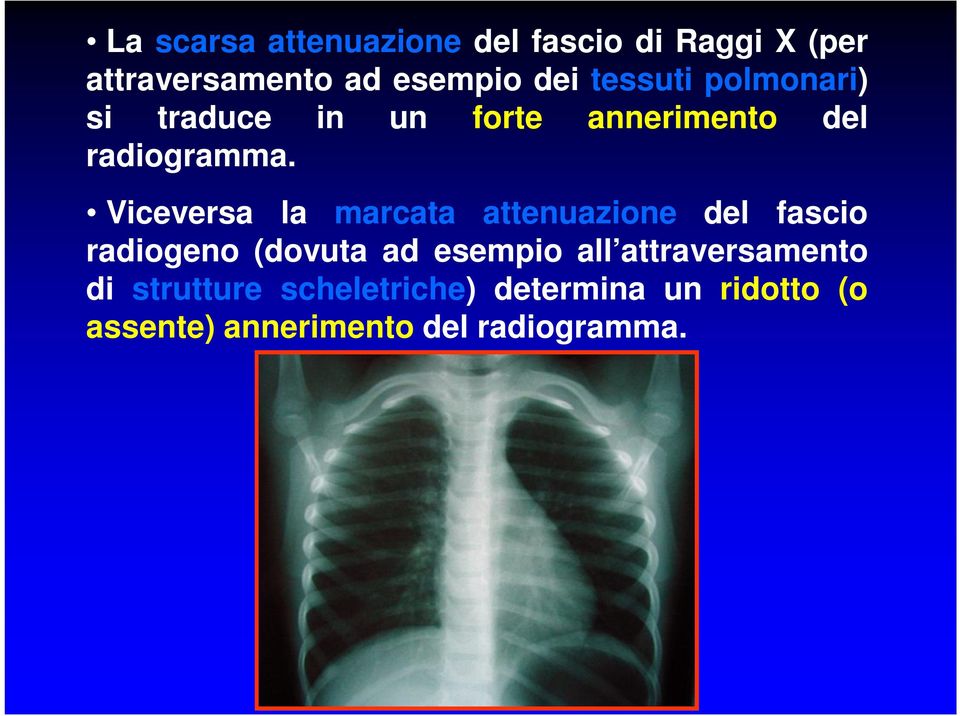 Viceversa la marcata attenuazione del fascio radiogeno (dovuta ad esempio all