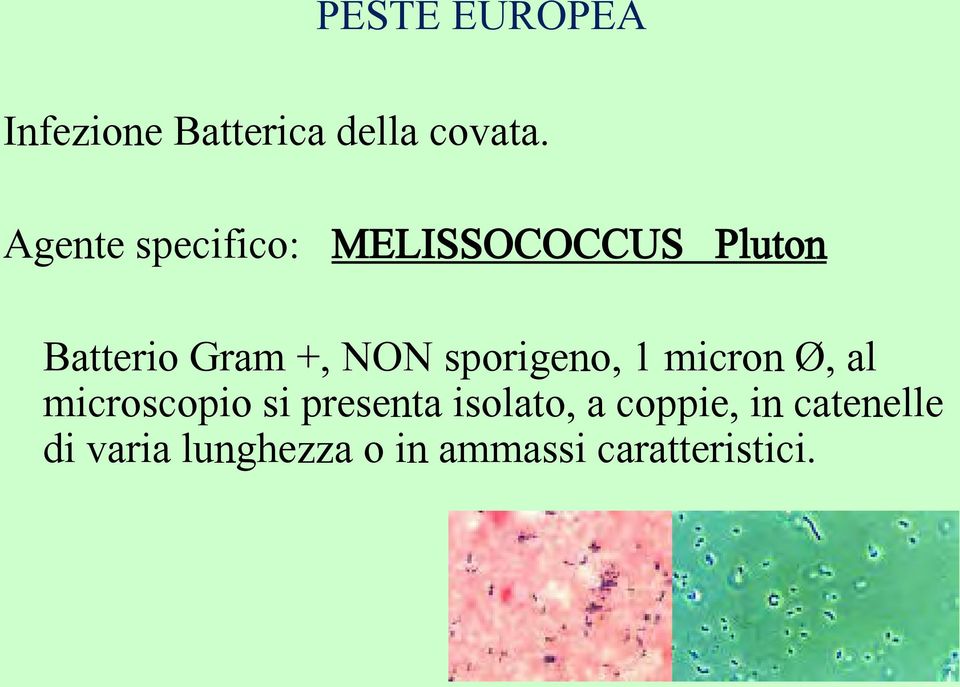 sporigeno, 1 micron Ø, al microscopio si presenta isolato,