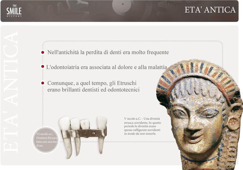 odontotecnici VI secolo a.c. - Dentiera Etrusca fatta con una barra d'oro V secolo a.c. - Una divinità etrusca sorridente.