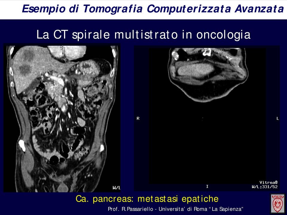 oncologia Ca.