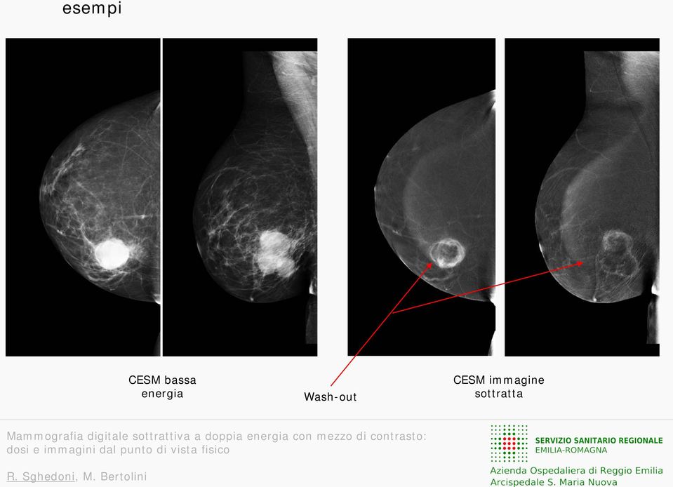 Wash-out CESM