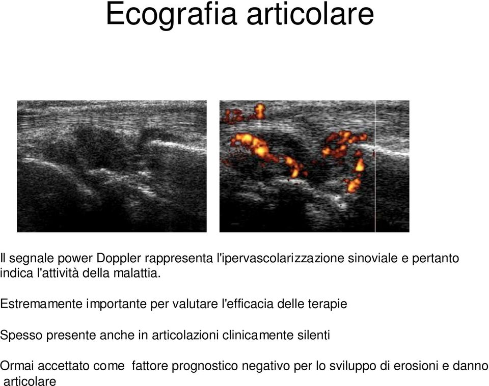 Estremamente importante per valutare l'efficacia delle terapie Spesso presente anche in