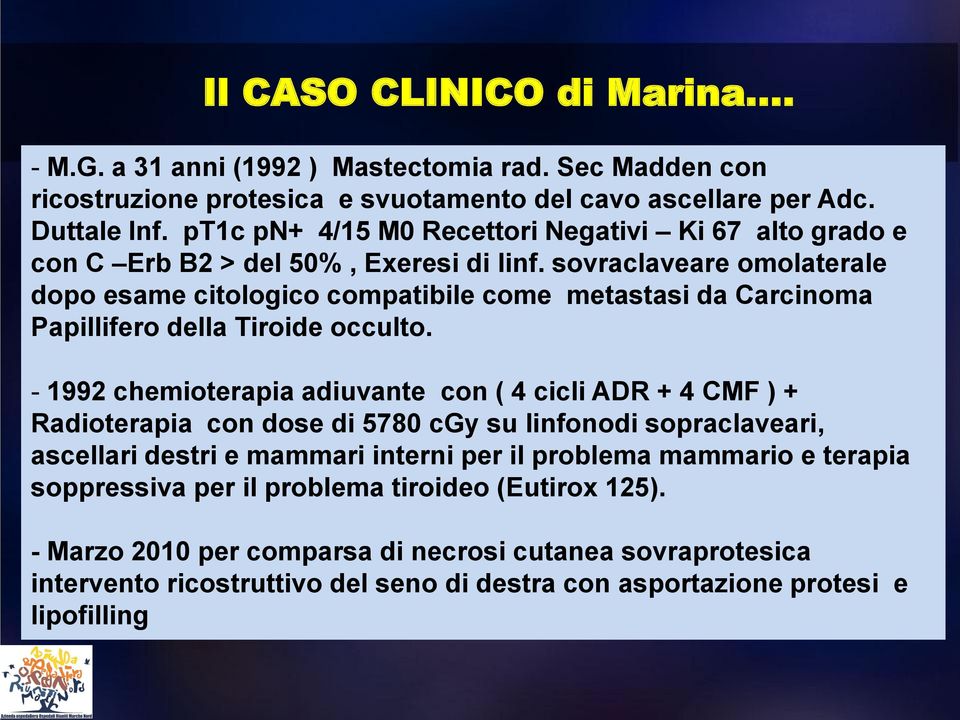 sovraclaveare omolaterale dopo esame citologico compatibile come metastasi da Carcinoma Papillifero della Tiroide occulto.