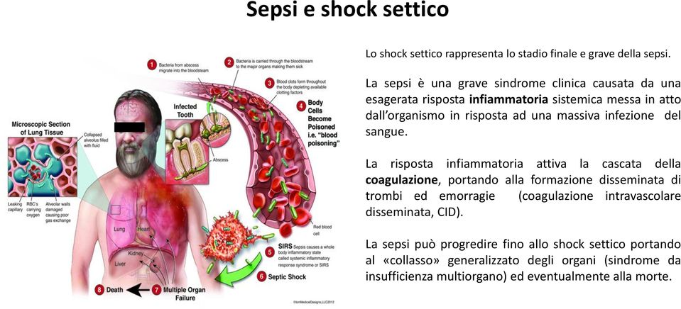 massiva infezione del sangue.