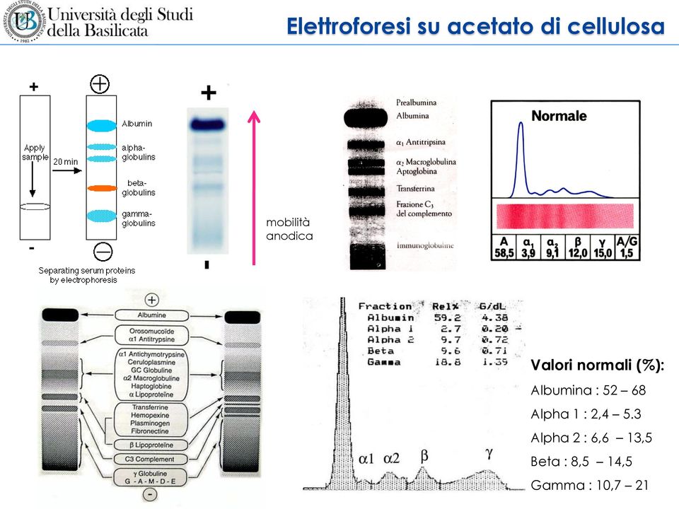 Albumina : 52 68 Alpha 1 : 2,4 5.
