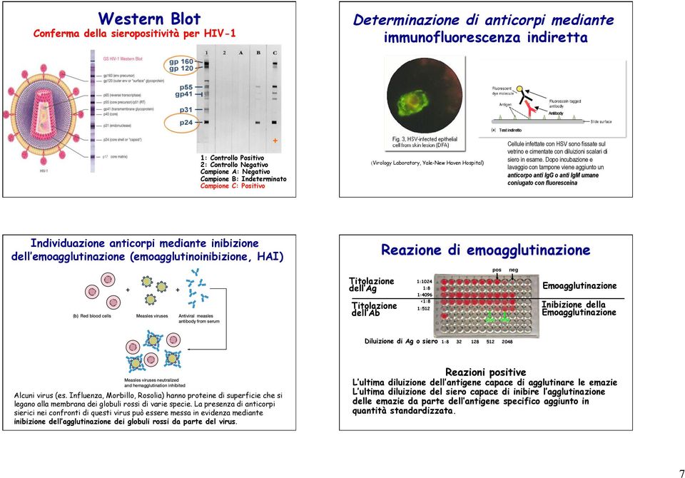 Dopo incubazione e lavaggio con tampone viene aggiunto un anticorpo anti IgG o anti IgM umane coniugato con fluoresceina Individuazione anticorpi mediante inibizione dell emoagglutinazione