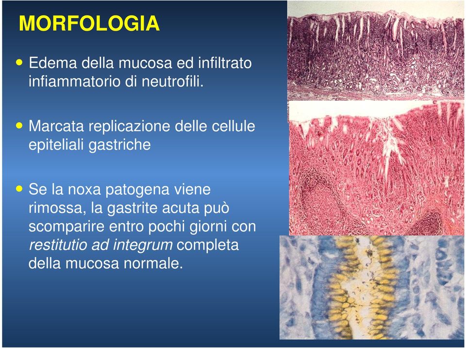 Marcata replicazione delle cellule epiteliali gastriche Se la noxa